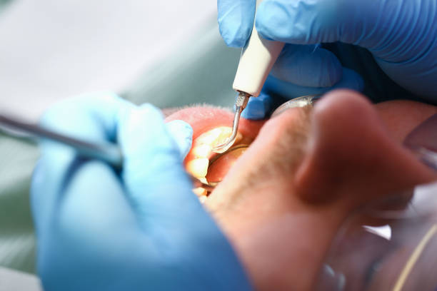 Best Emergency Dental Services Near Me  in Bristol, VA